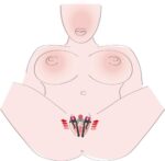 Klipsy do warg sromowych