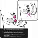 JOYBALLS SECRET – Piękno, Nowoczesność i Dyskretna Przyjemność